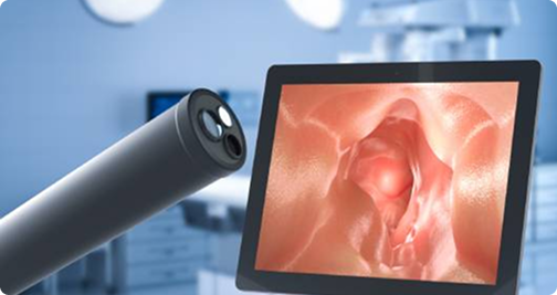 Imagen de endoscopía